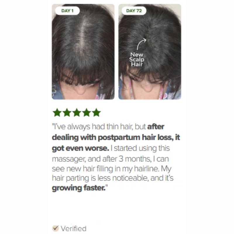 LED HAIR THERAPY BRUSH