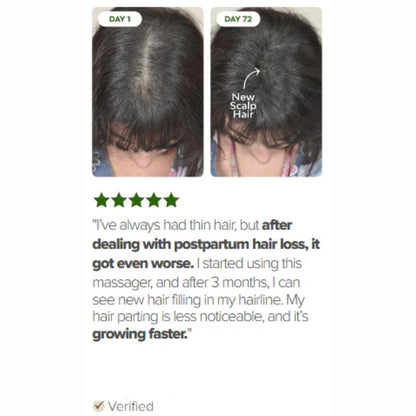 LED HAIR THERAPY BRUSH