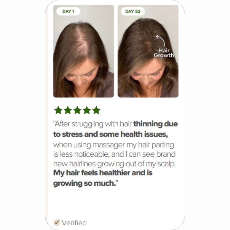 LED HAIR THERAPY BRUSH