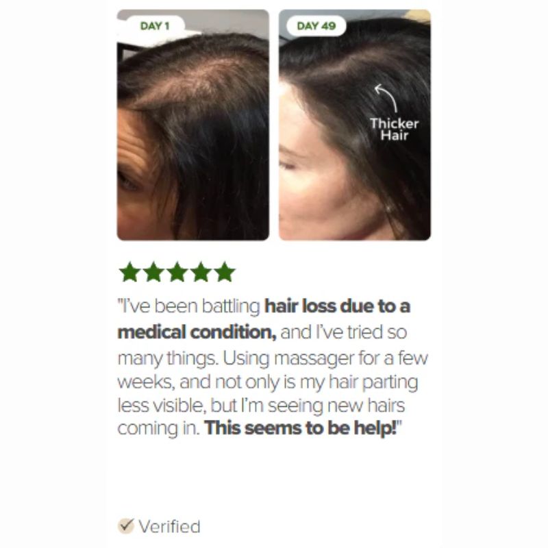 LED HAIR THERAPY BRUSH